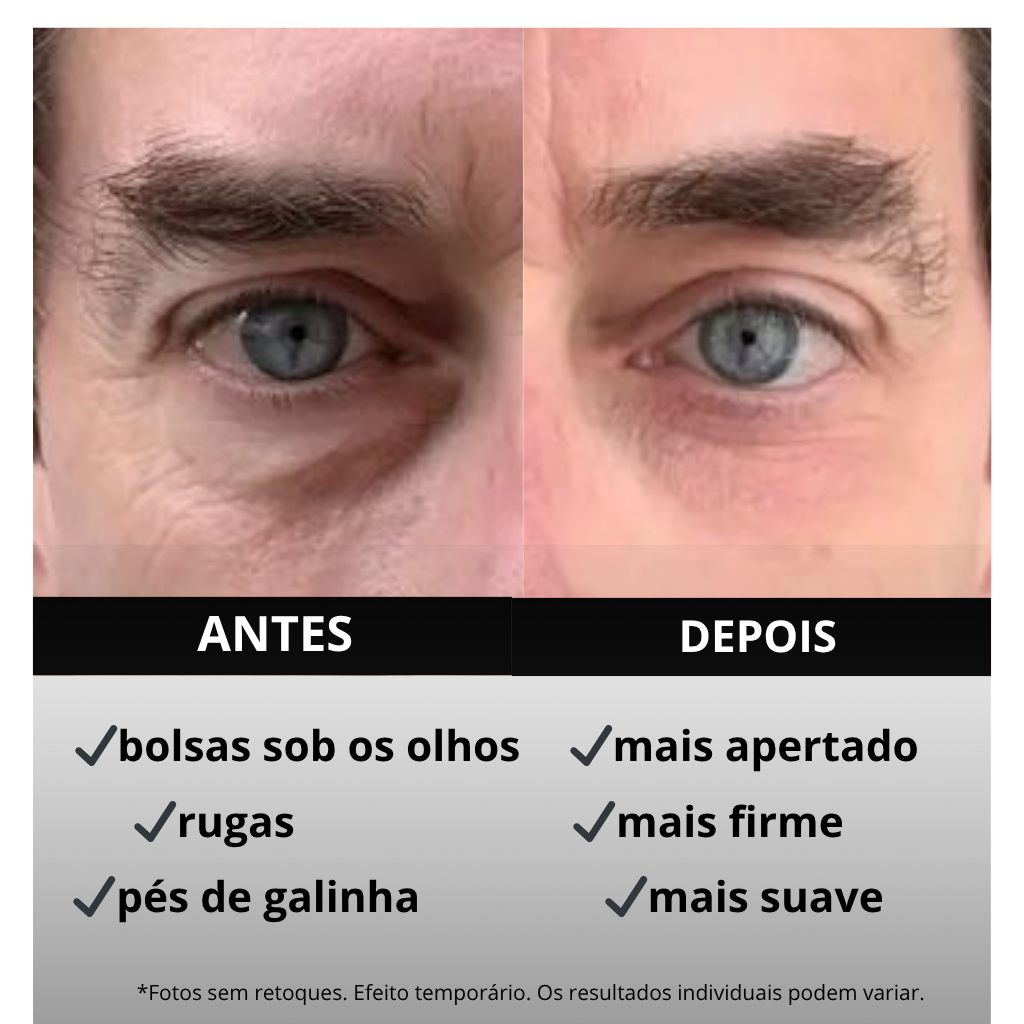Creme firmador para a área dos olhos, remove olheiras