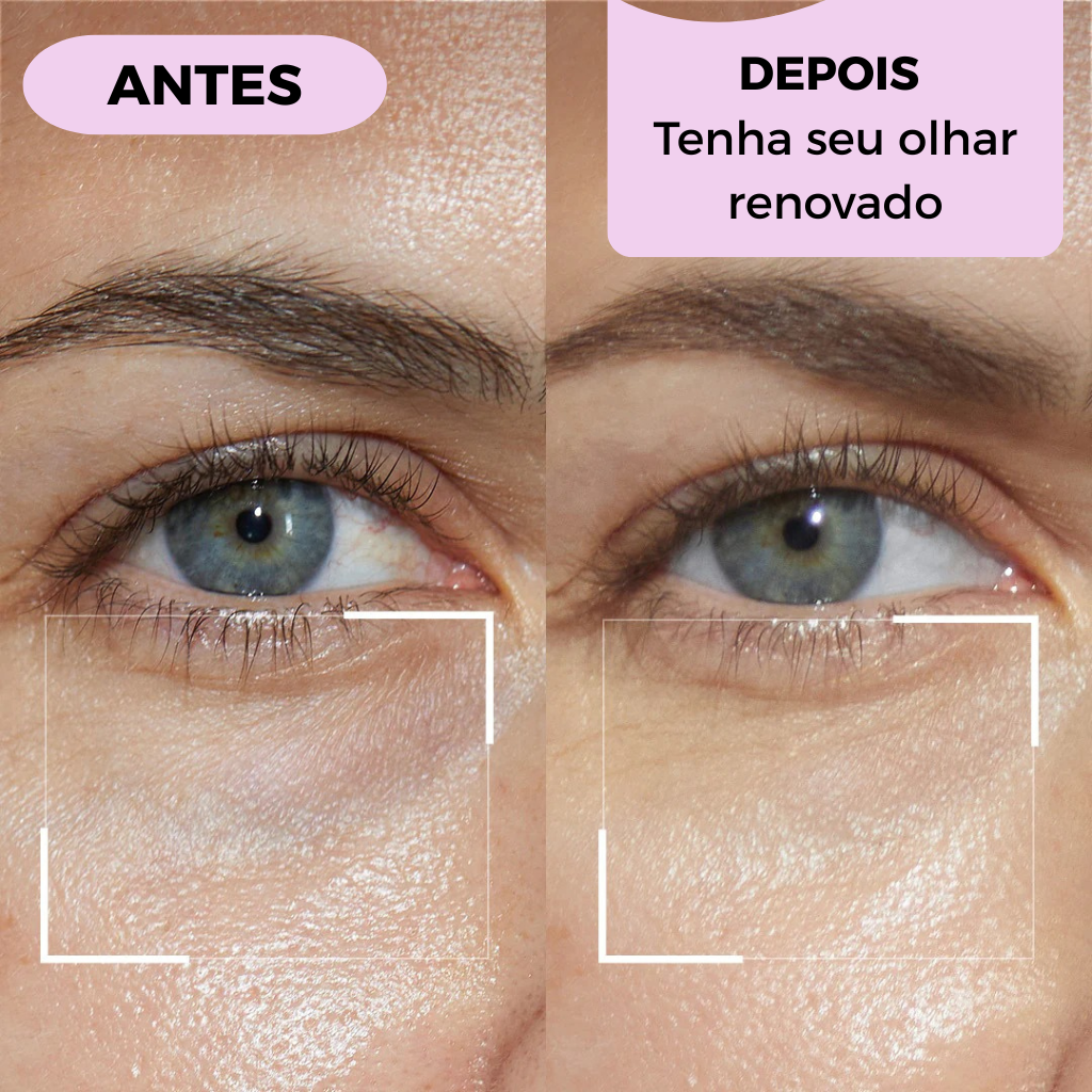 Creme firmador para a área dos olhos, remove olheiras